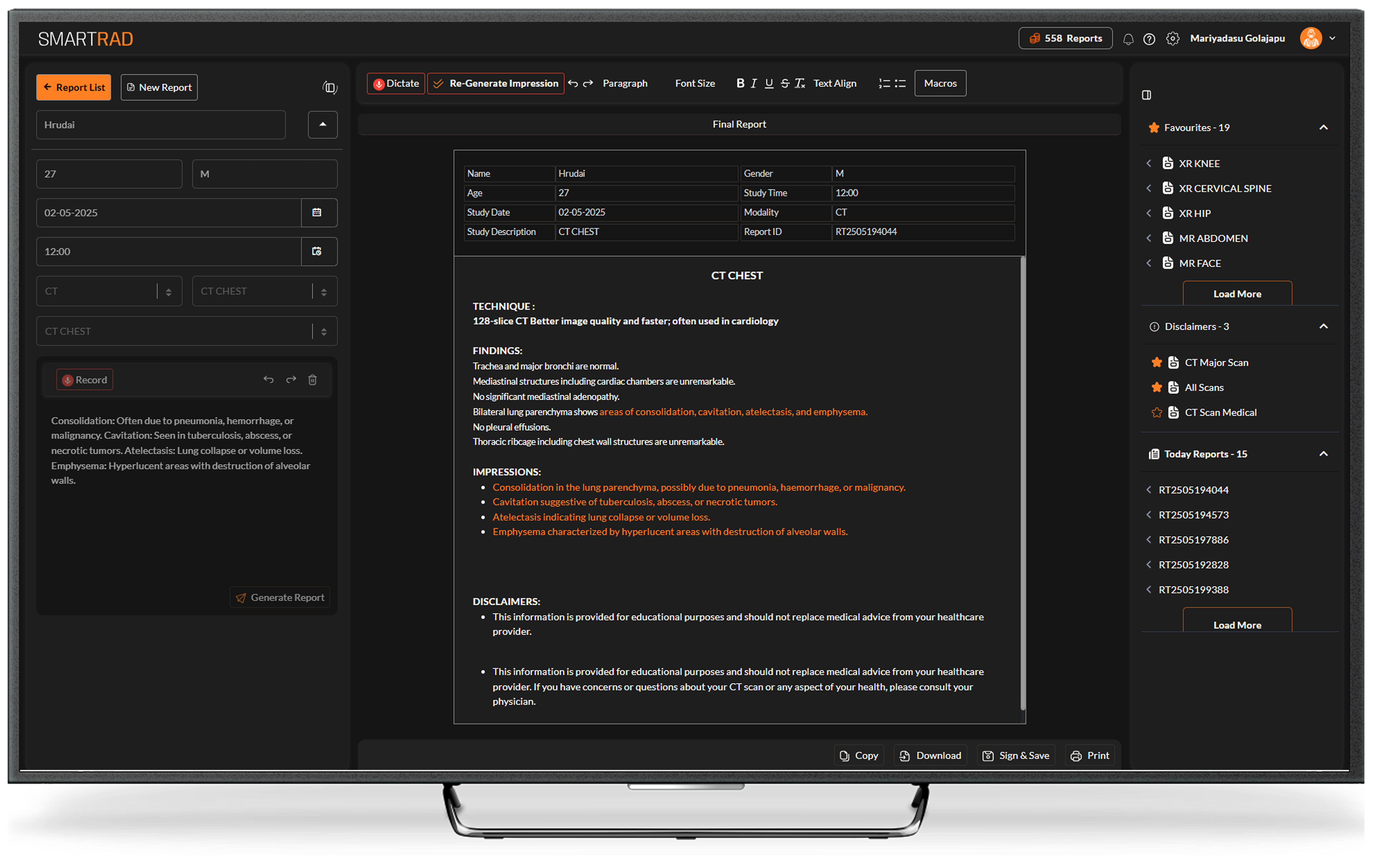 radiogram-editor